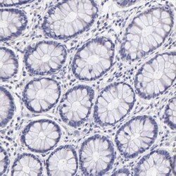 ER alpha/NR3A1 Antibody, Novus Biologicals 25 &mu;L; Unlabeled:Antibodies,