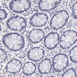 ER alpha/NR3A1 Antibody, Novus Biologicals:Antibodies:Primary Antibodies