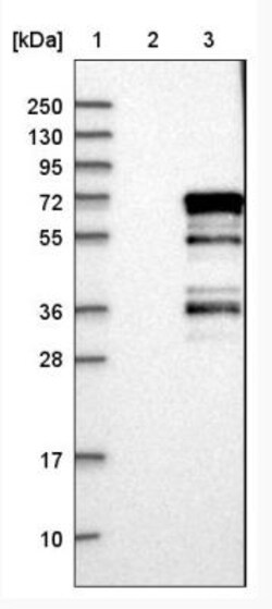 ER alpha/NR3A1 Antibody, Novus Biologicals 25 &mu;L; Unlabeled:Antibodies,