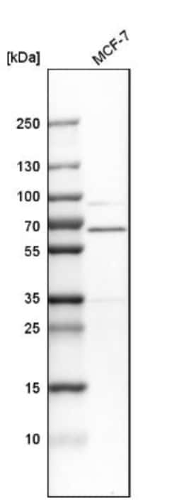 ER alpha/NR3A1 Antibody, Novus Biologicals:Antibodies:Primary Antibodies