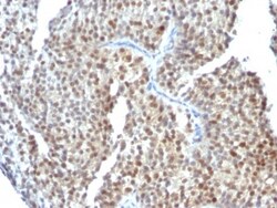 ER beta/NR3A2 Antibody (ESR2/686), Novus Biologicals 0.2mg; Unlabeled:Antibodies,