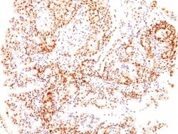 ER beta/NR3A2 Antibody (ESR2/686), Novus Biologicals 0.2mg; Unlabeled:Antibodies,