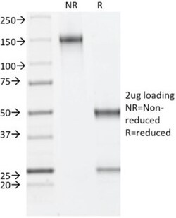 ER beta/NR3A2 Antibody (ESR2/686), Novus Biologicals 0.2mg; Unlabeled:Antibodies,