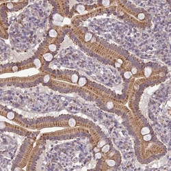 ERG28 Antibody, Novus Biologicals 25 &mu;L; Unlabeled:Antibodies, Polyclonal