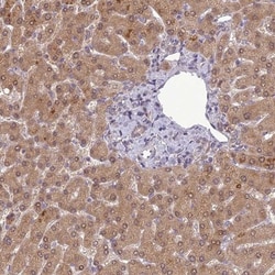 ERG28 Antibody, Novus Biologicals 25 &mu;L; Unlabeled:Antibodies, Polyclonal