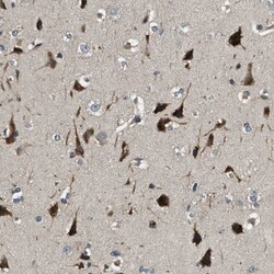 ERGIC1 Antibody, Novus Biologicals 0.1mL; Unlabeled:Antibodies, Polyclonal