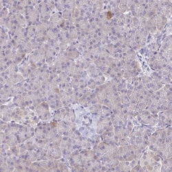 ERMN Antibody, Novus Biologicals 25 &mu;L; Unlabeled:Antibodies, Polyclonal