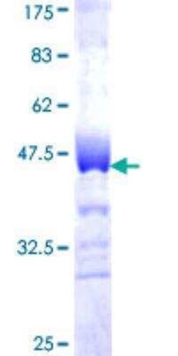 Novus Biologicals Recombinant Human ERManI GST (N-Term) Protein 25 &mu;g | Buy Online | Novus Biologicals&trade; | Fisher Scientific