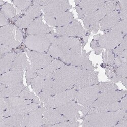 ERO1L Antibody, Novus Biologicals 25ul | Buy Online | Novus Biologicals | Fisher Scientific