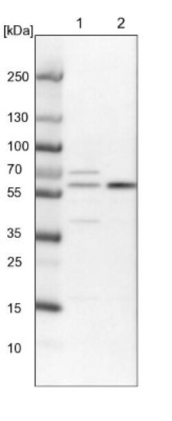 ERO1L Antibody, Novus Biologicals 25ul | Buy Online | Novus Biologicals | Fisher Scientific
