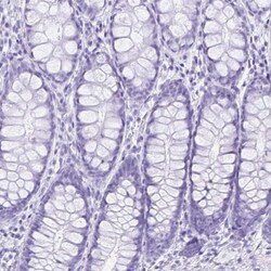 ERP27 Antibody, Novus Biologicals 0.1mL; Unlabeled:Antibodies, Polyclonal
