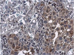 ERRFI1 Antibody, Novus Biologicals 0.1mL; Unlabeled:Antibodies, Polyclonal