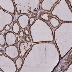 ERp57/PDIA3 Antibody (CL2444), Novus Biologicals 0.1mL; Unlabeled:Antibodies,