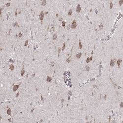 ERp57/PDIA3 Antibody (CL2444), Novus Biologicals 0.1mL; Unlabeled:Antibodies,