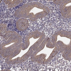 ERp57/PDIA3 Antibody (CL2444), Novus Biologicals 0.1mL; Unlabeled:Antibodies,