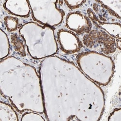 ERp57/PDIA3 Antibody, Novus Biologicals:Antibodies:Primary Antibodies