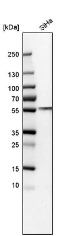 ERp57/PDIA3 Antibody, Novus Biologicals:Antibodies:Primary Antibodies