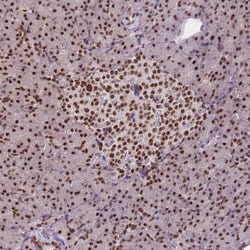 ESF1 Antibody, Novus Biologicals:Antibodies:Primary Antibodies