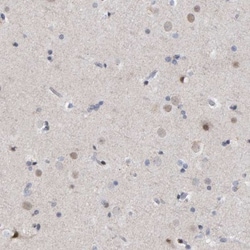 ESRP1 Antibody, Novus Biologicals 0.1mL; Unlabeled:Antibodies, Polyclonal