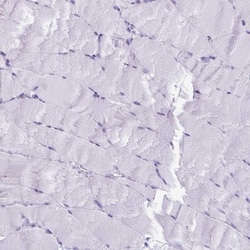 ESX1 Antibody, Novus Biologicals 25 &mu;L, Unlabeled:Antibodies, Polyclonal