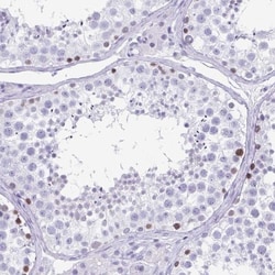ESX1 Antibody, Novus Biologicals 25 &mu;L, Unlabeled:Antibodies, Polyclonal
