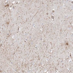 ETAA1 Antibody, Novus Biologicals:Antibodies:Primary Antibodies