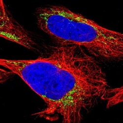 ETFA Antibody, Novus Biologicals:Antibodies:Primary Antibodies