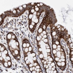 ETFA Antibody, Novus Biologicals:Antibodies:Primary Antibodies