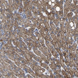 ETFA Antibody, Novus Biologicals:Antibodies:Primary Antibodies