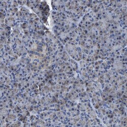 ETFA Antibody, Novus Biologicals:Antibodies:Primary Antibodies