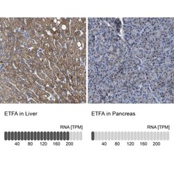 ETFA Antibody, Novus Biologicals:Antibodies:Primary Antibodies