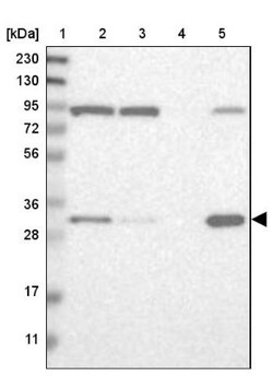 ETFA Antibody, Novus Biologicals:Antibodies:Primary Antibodies