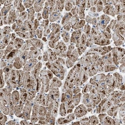 ETFB Antibody, Novus Biologicals 25 &mu;L; Unlabeled:Antibodies, Polyclonal