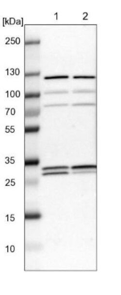 ETFB Antibody, Novus Biologicals 25 &mu;L | Buy Online | Novus Biologicals | Fisher Scientific