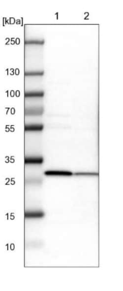 ETFB Antibody, Novus Biologicals 25 &mu;L; Unlabeled:Antibodies, Polyclonal