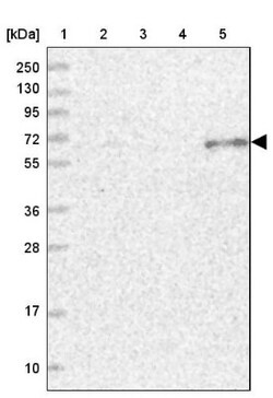 ETFDH Antibody, Novus Biologicals:Antibodies:Primary Antibodies