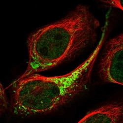 ETHE1 Antibody, Novus Biologicals 25 &mu;L | Buy Online | Novus Biologicals | Fisher Scientific