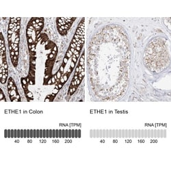 ETHE1 Antibody, Novus Biologicals 25 &mu;L | Buy Online | Novus Biologicals | Fisher Scientific