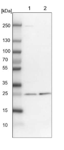 ETHE1 Antibody, Novus Biologicals 25 &mu;L | Buy Online | Novus Biologicals | Fisher Scientific