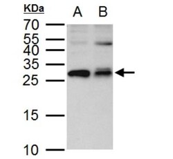 ETHE1 Antibody, Novus Biologicals 0.1mL; Unlabeled:Antibodies, Polyclonal