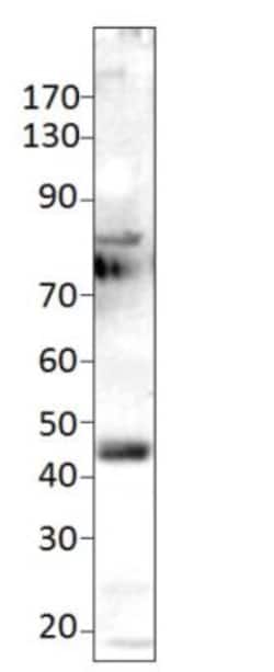 Novus Biologicals&trade;&nbsp;ETS1 associated protein II Antibody Blocking Peptide