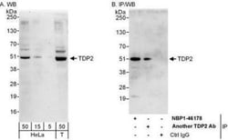 ETS1 associated protein II Antibody, Novus Biologicals 0.1mL; Unlabeled:Antibodies,