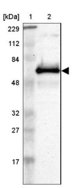 ETV3 Antibody, Novus Biologicals 25ul | Buy Online | Novus Biologicals | Fisher Scientific