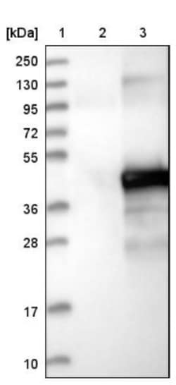 ETV7 Antibody, Novus Biologicals:Antibodies:Primary Antibodies
