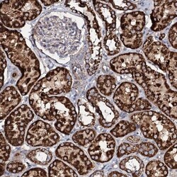 EVC2 Antibody, Novus Biologicals 0.1mL; Unlabeled:Antibodies, Polyclonal