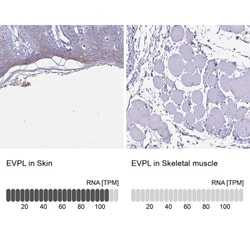 EVPL Antibody, Novus Biologicals:Antibodies:Primary Antibodies