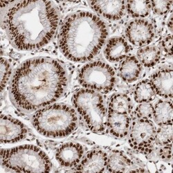 EYA2 Antibody, Novus Biologicals:Antibodies:Primary Antibodies