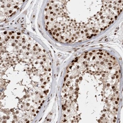 EYA2 Antibody, Novus Biologicals:Antibodies:Primary Antibodies