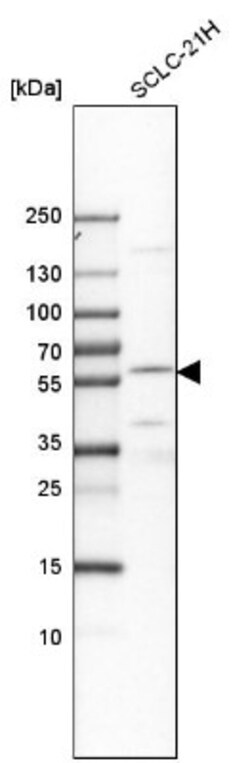 EYA2 Antibody, Novus Biologicals:Antibodies:Primary Antibodies