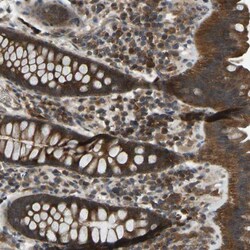 EZFIT/ZNF71 Antibody, Novus Biologicals:Antibodies:Primary Antibodies